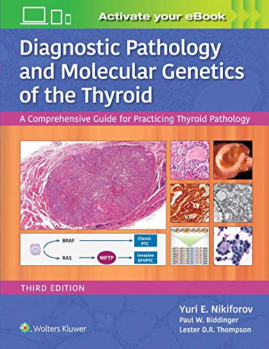 Diagnostic Pathology And Molecular Genetics Of The Thyroid: A Comprehensive Guide For Practicing Thyroid Pathology
