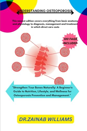 Understanding Osteoporosis: "Strengthen Your Bones Naturally: A Beginner'S Guide To Nutrition, Lifestyle, And Wellness For Osteoporosis Prevention And