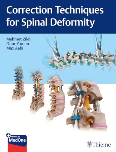 Correction Techniques For Spinal Deformity