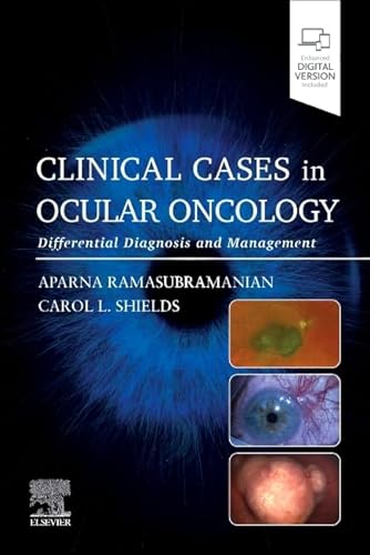 Clinical Cases In Ocular Oncology: Differential Diagnosis And Management
