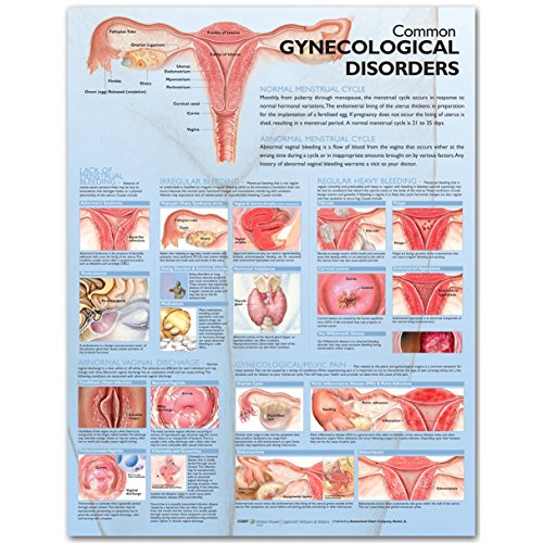Common Gynecological Disorders Anatomical Chart
