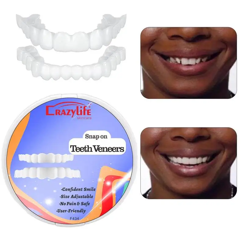 Snap On Teeth Top And Bottom Snap On Teeth Impiallacciature Per Uomini E Donne Coprono I Denti Dente Finto Sorriso Istantaneo Di Fiducia