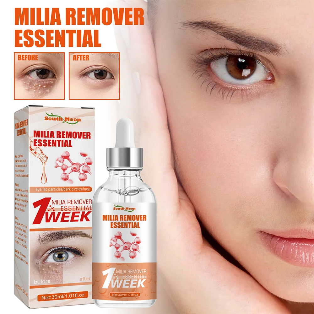 30Ml Milia Remover Essential Remove Fat Particles Occhiaie Ridurre Edema Borse Per Gli Occhi Dissolvenza Linee Sottili Rassodante Lifting Eye Serum