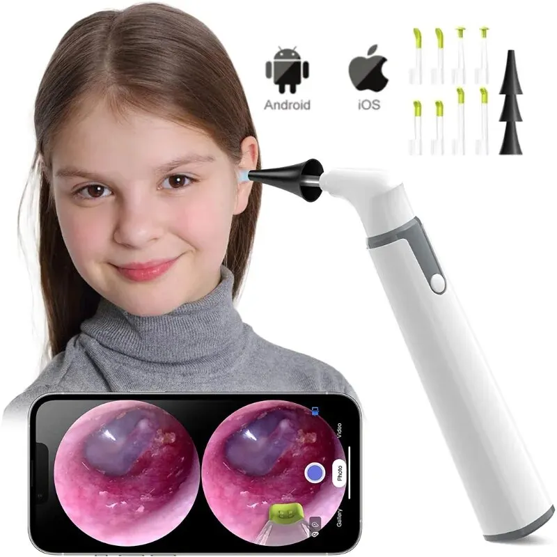 Visual Ear Scoop Endoscopio Wifi Wireless Otoscopio Rimozione Cerume 3.9Mm 720P Scattare Foto Video Compatibile Con Ios Android