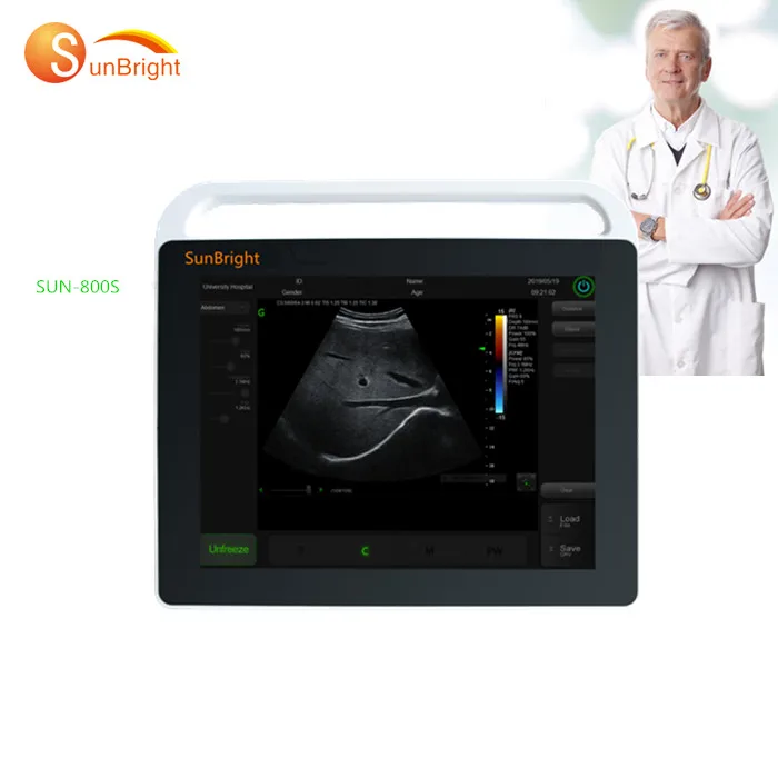 Ecocardiografia Portatile/Doppler Color Ultrasonido Equipo/Ecografo