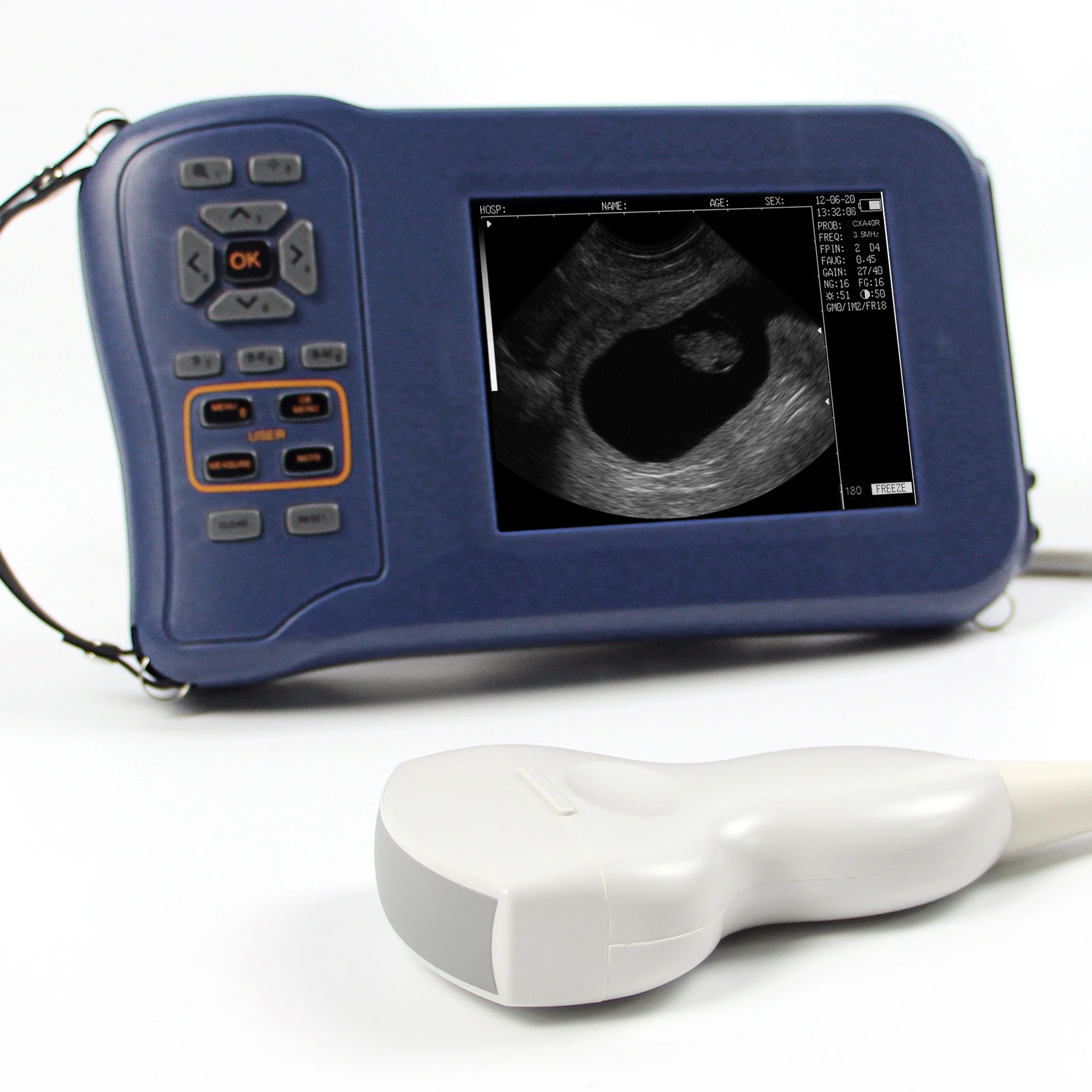 Scanner Ad Ultrasuoni Portatile/Ecografo Portatil Veterinaria