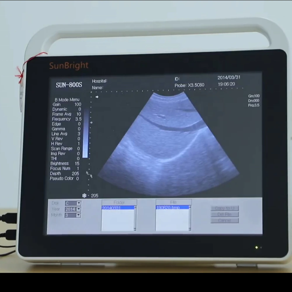 Ecografo Ecografo Portatil Touch Screen Ecograph Best Sonoscape Selling Ultrasound Machine