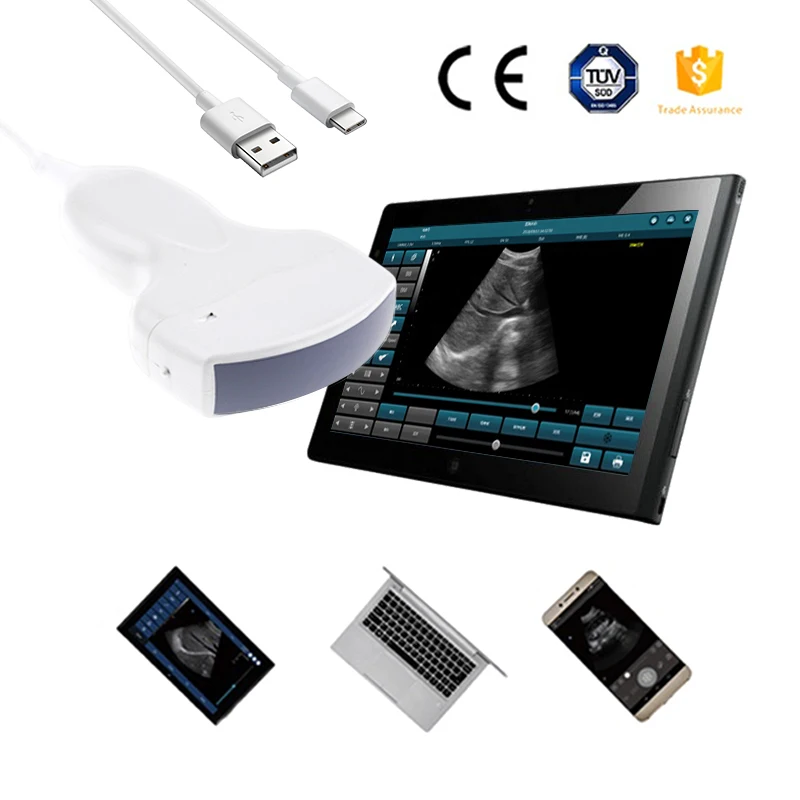 Usb Ecografo Portatil Ultrasonido Portable Ultrasound Machine For Sale