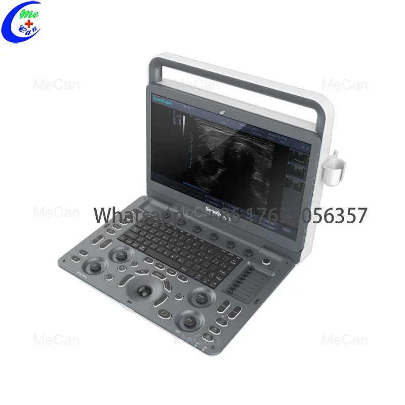 Portable Color Doppler Ultrasound Machine Ecografo Sonoscape E2 Ultrasound Machine
