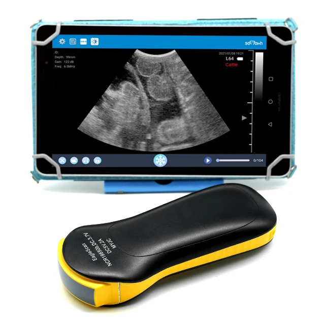 Ultrasuoni Ecografo Medici Per Laptop Portatili A Prezzi Ridotti Per Ospedali