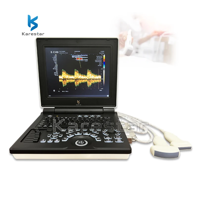 Ecografo Portatil Strumenti Ecografici Medici Portatili Ecografia Ecografia Doppler Con Funzione Pw