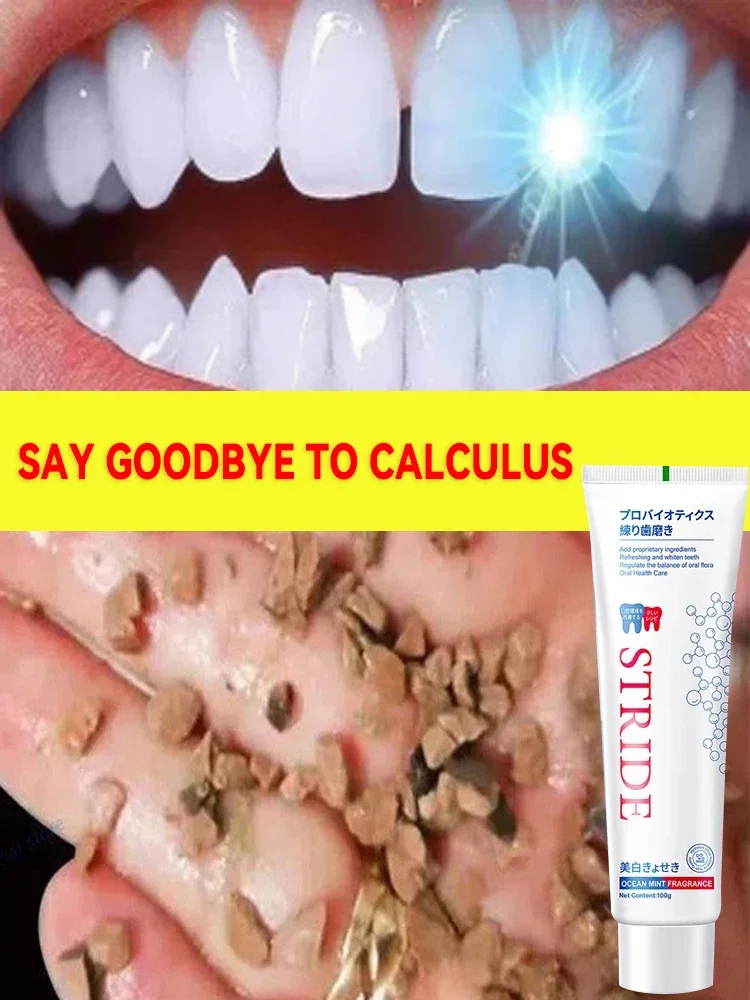 Rimozione Del Tartaro Dentale Sbiancamento Dei Denti Dentifricio Schiarente Prevenzione Della Parodontite Rimozione Dell'Alitosi Cura Della Pulizia De