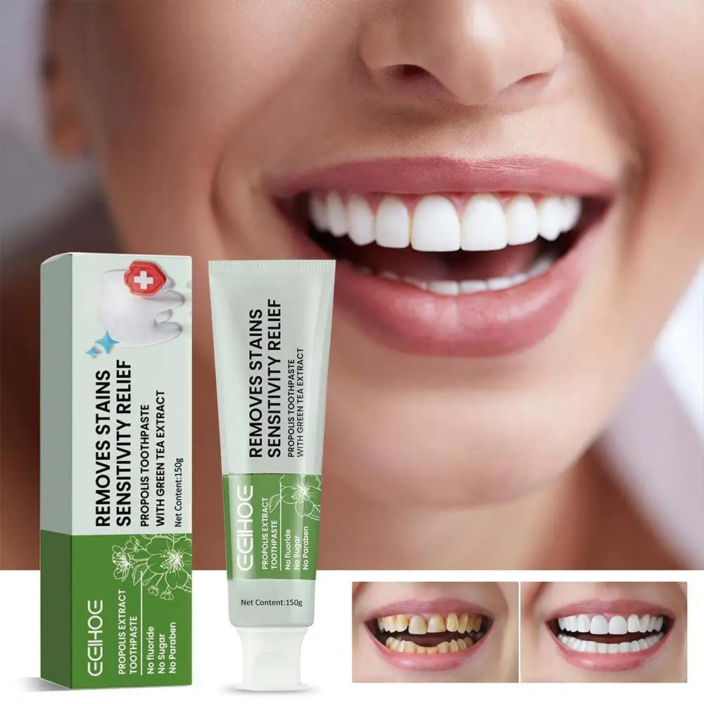 150G Di Rimozione Delle Macchie Sbiancante Dentifricio Propoli Anti-Placca Salute Dentale Alito Fresco Cura Delle Gengive Sbiancamento Pulizia Dei Den