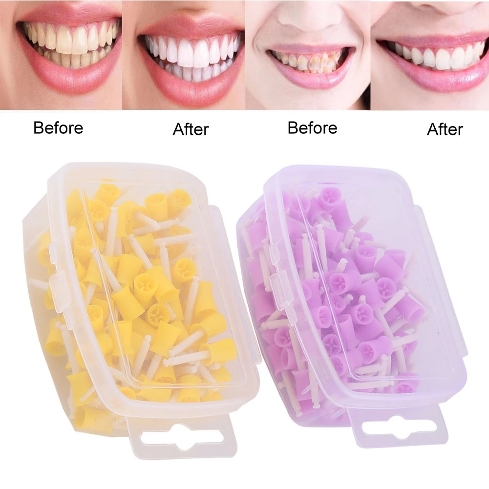 100 Pezzi/Set Denti Lucidatura Gomma Lucidatura Tazze Macchie Di Denti Rimozione Sbiancamento Dentista Strumenti Pulizia Orale Dentale