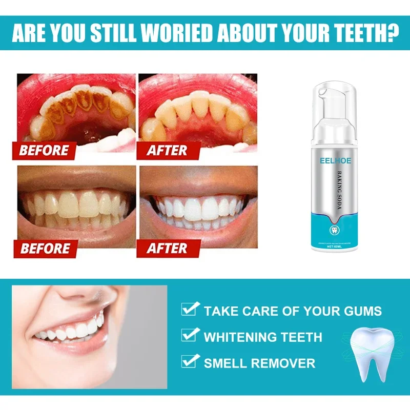 Sdutter Eelhoe Foam Dentifricio Press-Type Whitening Tooth Mousse Rimuovi Tartaro Giallo Macchie Di Fumo Dentifricio Per La Pulizia Orale