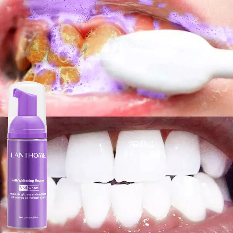 Mousse Sbiancante Per Denti Rimuovi Macchie Pulizia Dei Denti Denti Bianchi Sbiancamento Orale Igiene Dentifricio Schiarente Strumento Dentale Cura