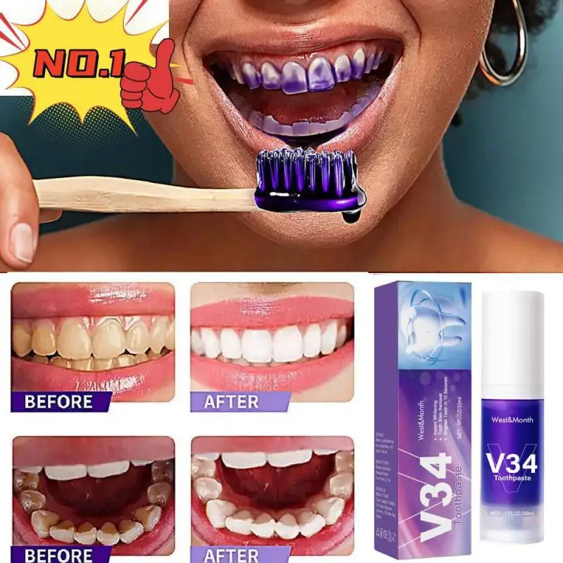 30Ml Mousse Detergente Per Denti Viola Pressa In Bottiglia Dentifricio Rinfresca L'Alito Sbianca Le Macchie Dei Denti Rimozione Delle Macchie Pulizia 
