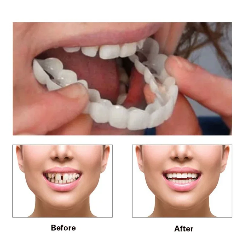 Copertura Per Denti Finti Perfect Fit Sbiancamento Dei Denti Snap On Silicone Smile Impiallacciature Denti Dentaduras Flexibles Strumento Di Bellezza 