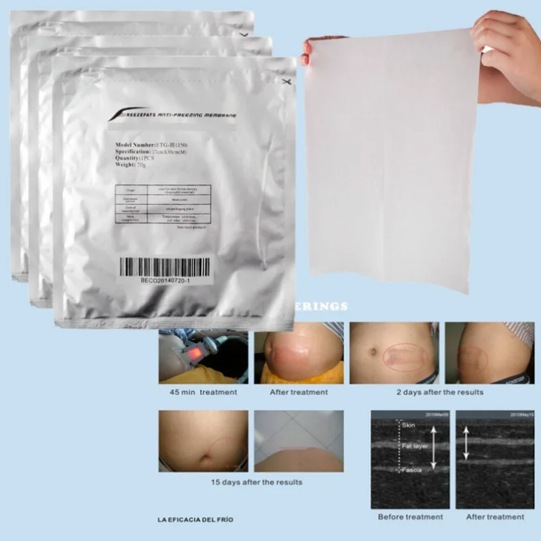 Membrana Anti-Congelamento Per Macchina Per Crioterapia Lipolaser Body Slimming Fat Freeze Cool Crioterapia Macchina Dimagrante Body Shapin