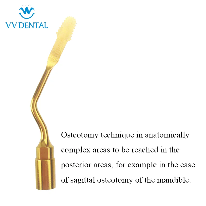 Vvdental Us9 Piezospurgery Tips Per Taglio Osseo Impianto Di Sollevamento Del Seno Adatto A Mectron/Nsk/Picchio