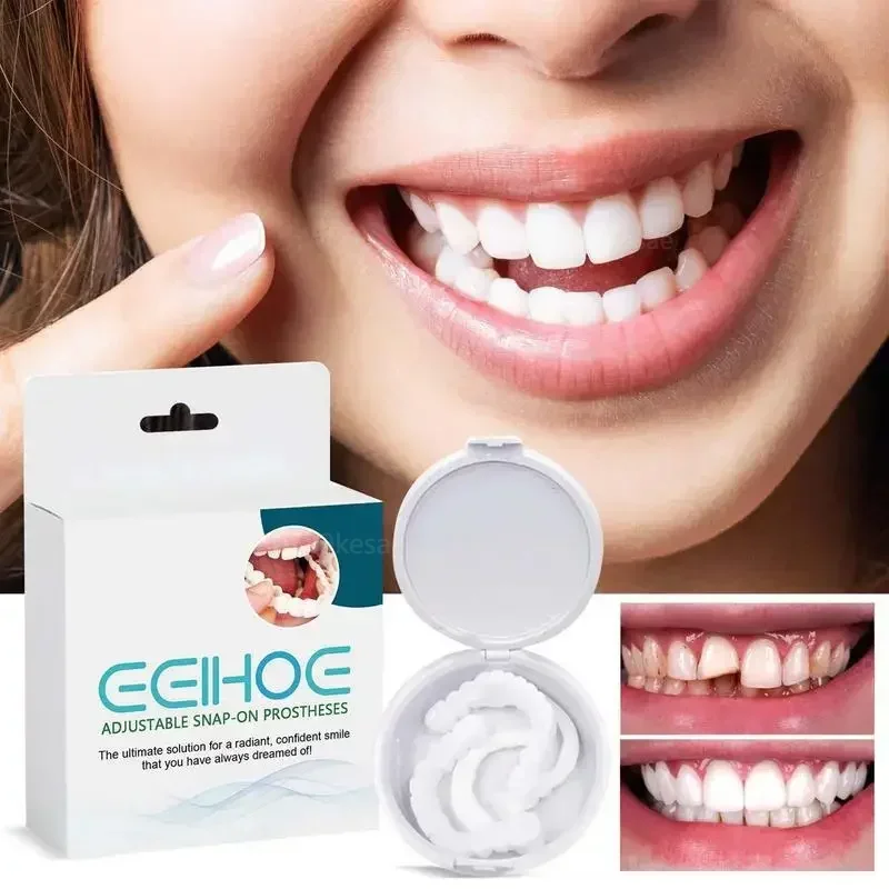 Scatola Di Immagazzinaggio Della Protesi Set Di Denti Per Protesi Regolabile Denti Per Protesi Impiallacciatura Sorridente Istantanea Sbiancamento Dei
