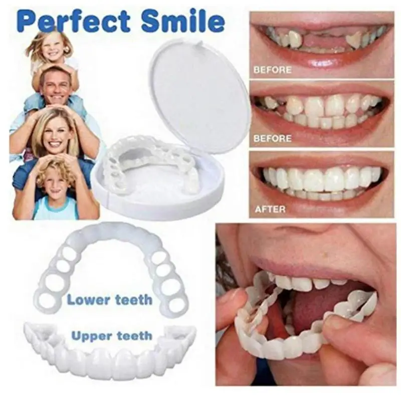 1 Set Di Impiallacciature Per Denti Copertura Per Denti Dentiere Impiallacciature Dentali Snap On Cover I Denti Denti Denti Finti Fiducia Istantanea S
