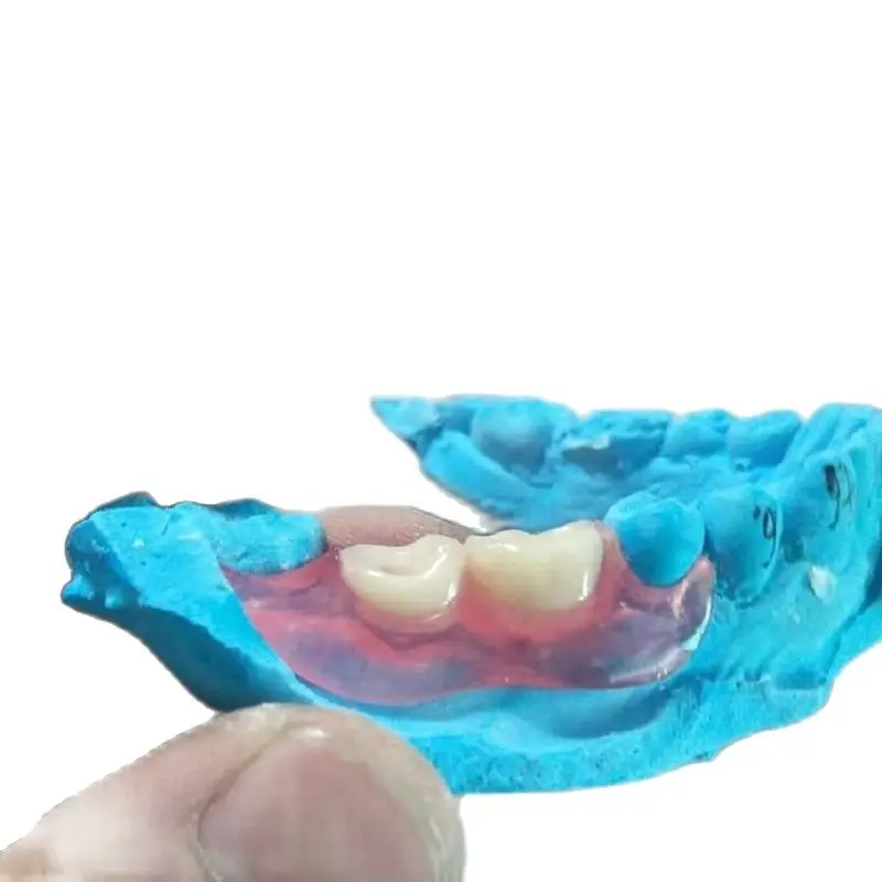 Denti Acrilici Della Protesi Dentaria Dei Materiali Flessibili Di Valplast Della Borsa 1000G Uno Per Le Protesi Parziale Con La Simulazione Della Stri