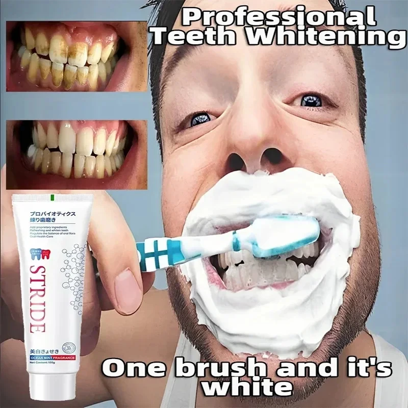 Rimozione Della Pietra Dentale Prevenzione Parodontite Sbiancamento Dei Denti Dentifricio Sbiancante Rimozione Dell'Alitosi Igiene Orale Cura 2024
