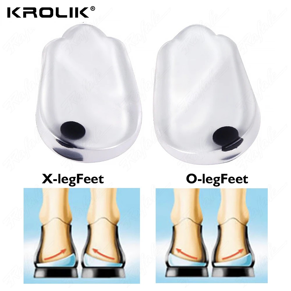 2 Pezzi Solette In Silicone Plantari X/O-Type Gambe Correttore Cuscino In Gel Per Tallone Solette Ortopediche Scarpe Pad Per Piedi Solette Per La Cura