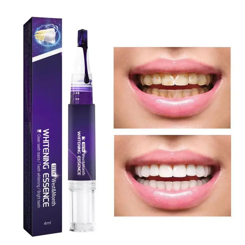 Sbiancante Per Denti Viola Stick Schiarente Per Denti E Gel Sbiancante Per Denti Delicato Con Effetto Sbiancante Penna Schiarente Per Denti Gialli
