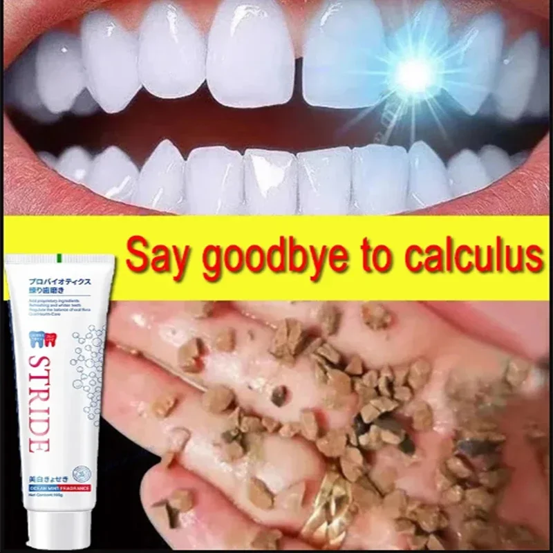 Calcolo Dentale Rimuovi Sbiancamento Denti Dentifricio Rimozione Schiarente Alitosi Prevenzione Dentale Parodontite Cura Della Pulizia