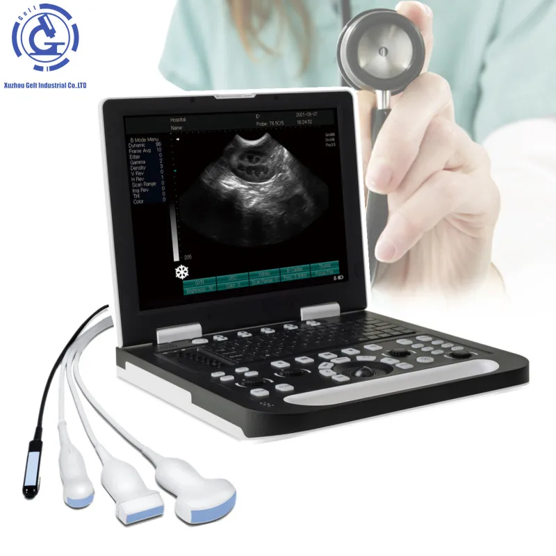 Sistema Di Imaging Diagnostico Ad Ultrasuoni Digitale Scanner Ad Ultrasuoni Ecografo Portatil M Alimentatore Ad Ultrasuoni