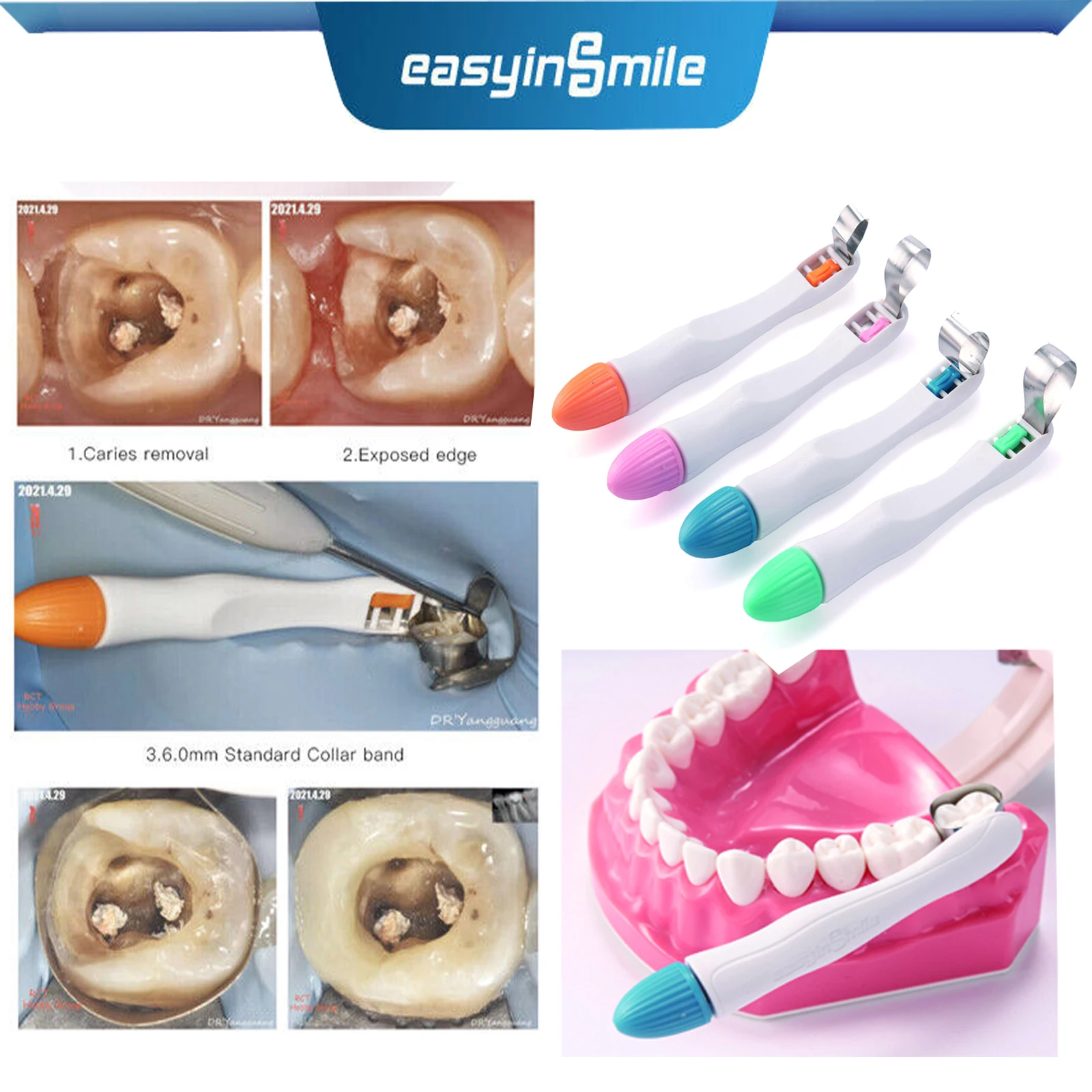 10 Pz Easyinsmile Formatura Dentale Foglio Matrix Bands Retainerless Automatrix Dentista Matrice Matrici Matrici Sagomate Sezionali