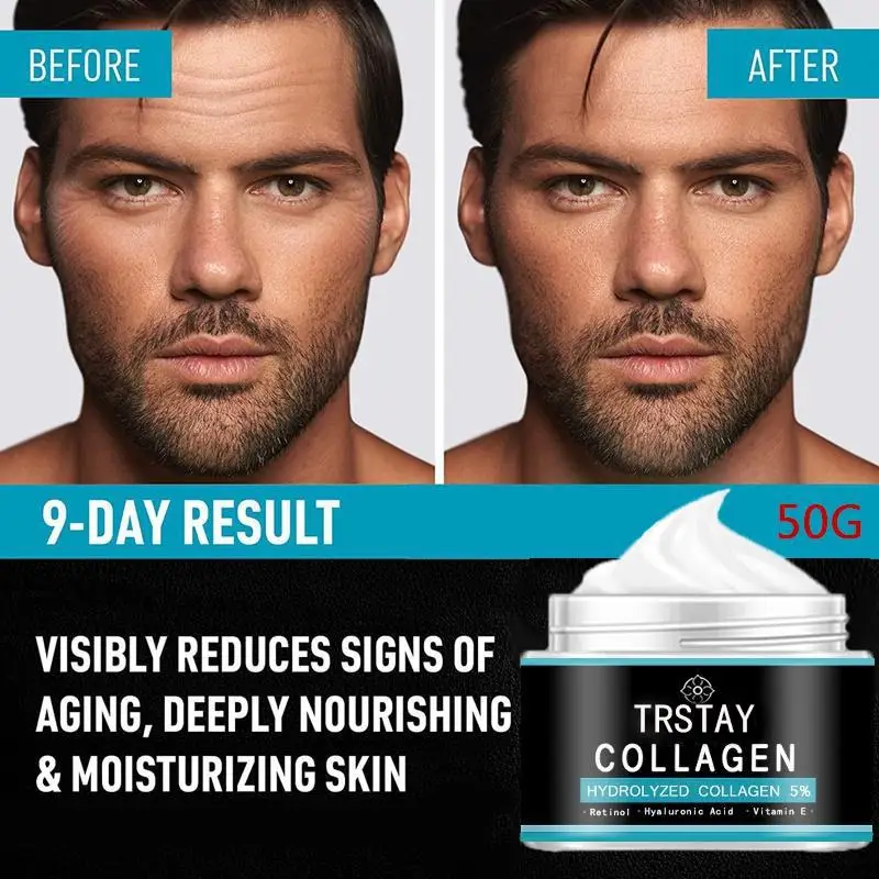 Crema Viso Idratante Naturale Biologica Giorno E Notte Crema Para Manchas De La Cara Crema Para Estrias