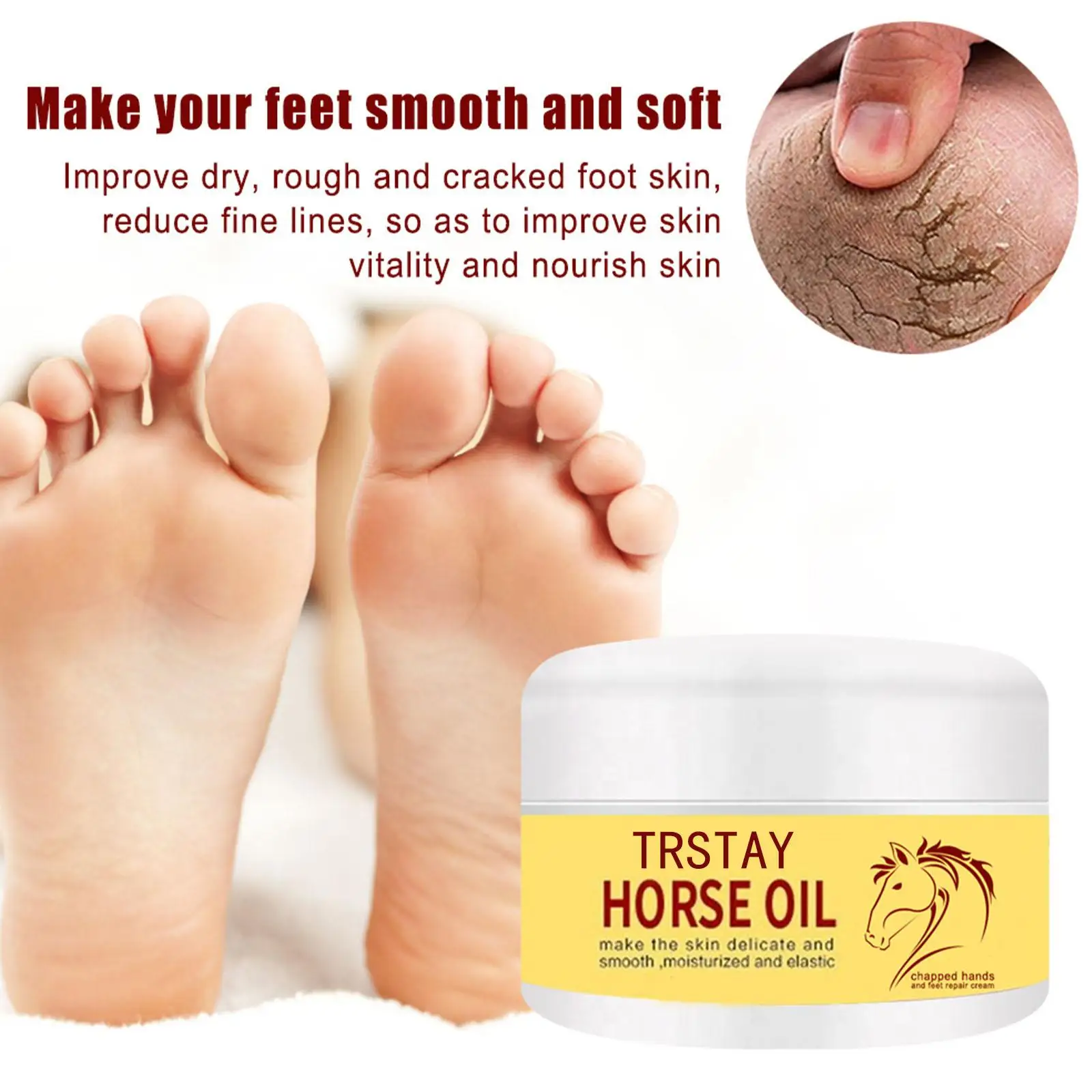 Crema Ai Piedi Crema Per Rimuovere Le Impurità In Eccesso Dai Piedi Crema Para Blanquear La Cara Cura Della Pelle Crema Para Estrias