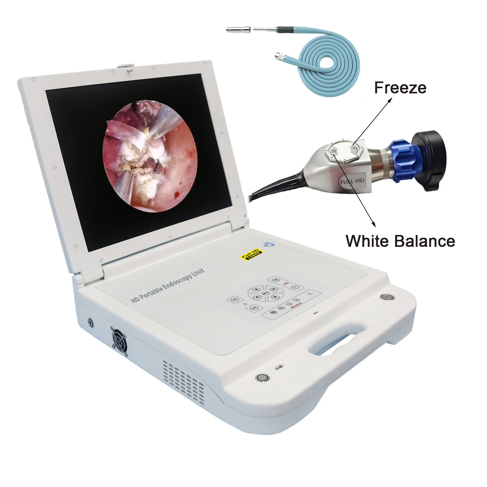Sistema Di Immagini Mediche 4 In 1 Unità Di Telecamere Per Endoscopia Portatile Full Hd Monitor Del Sistema Di Telecamere Per Endoscopio Sorgente Lumi