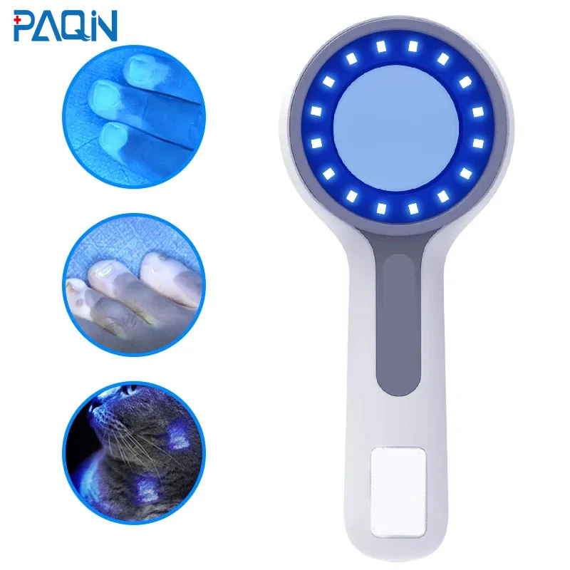 Dermatoscopio Skin Medical Magnifier Detection Woods Lamp Lampada Uva Per Il Rilevamento Della Vitiligine