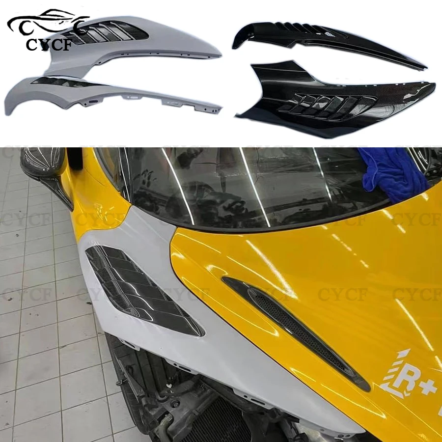 Davvero In Fibra Di Carbonio Per Mclaren 720S Car Front Side Fender Trim Decorativo Open-Hole Fender Accessori Per Auto Kit Carrozzeria