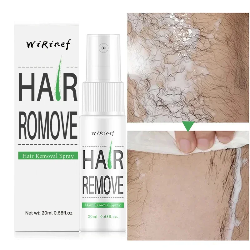Spray Permanente Per La Depilazione Parti Intime Ascella Braccia Per Le Gambe Inibitore Della Crescita Dei Capelli Depilatorio Veloce Indolore Uomo Do