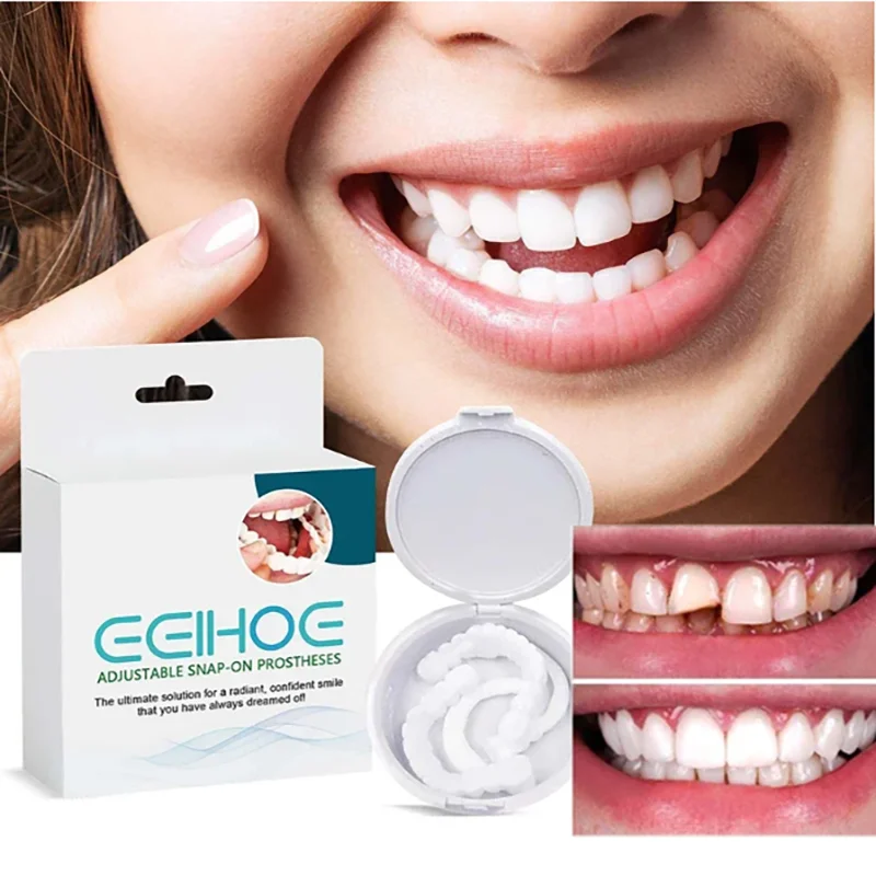 Dente Finto Protesi Regolabile Denti Perfetti Denti Dentiera Sorridente Istantanea Impiallacciatura Denti Resina Protesi Denti Temporanei Bretelle Den