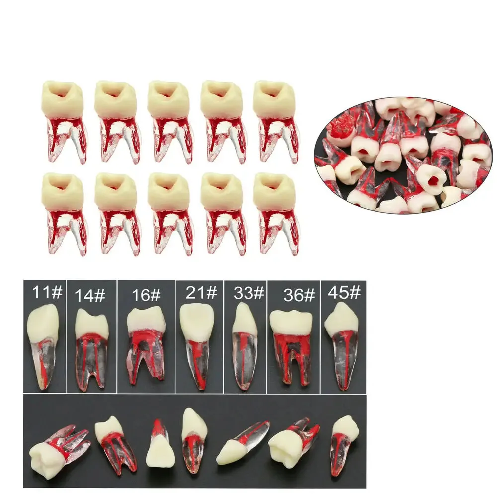 Dental Typodont Rct Root Channels Practice Pulp Study Modello Di Denti Endodontici