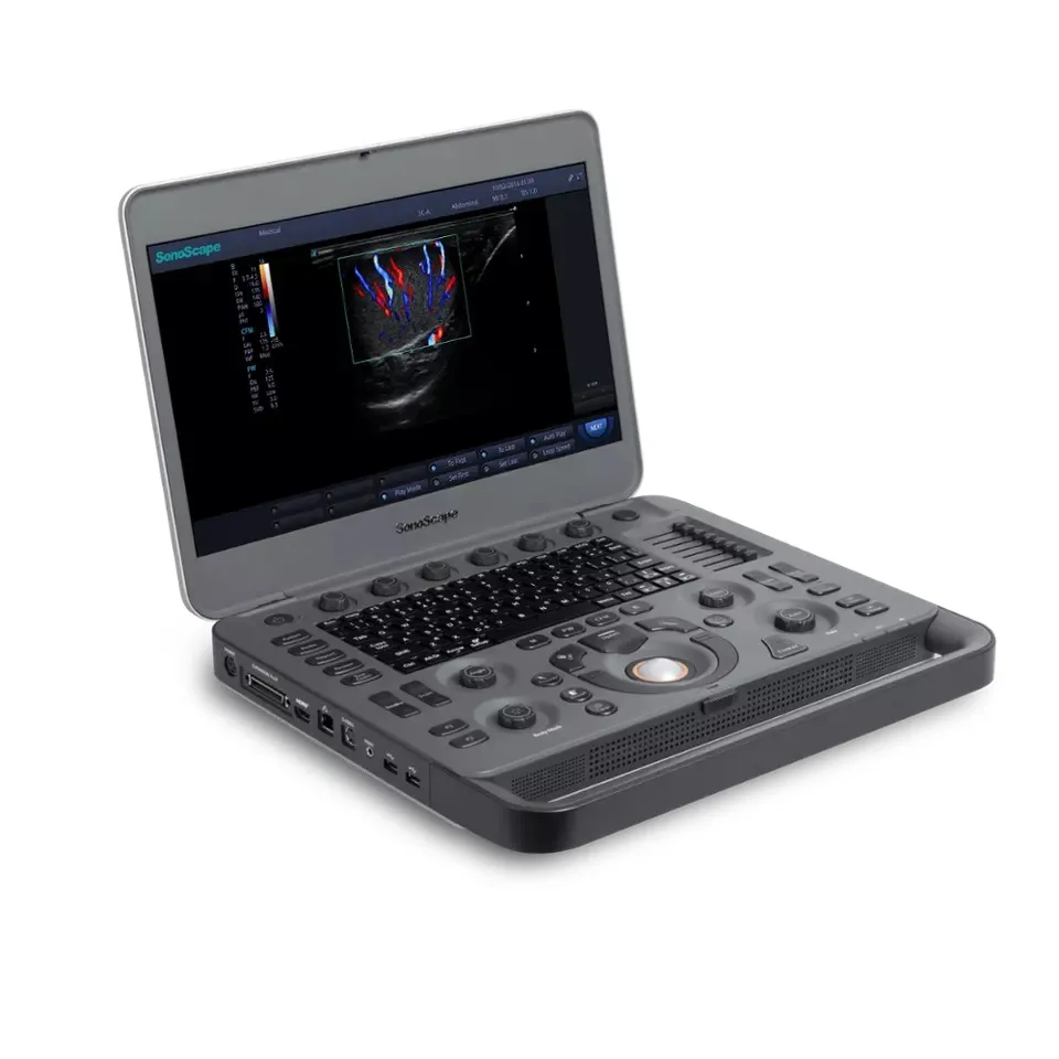 Prodotti Soggetti A Negozionationhigh End 4D Ecografo Medical Ultrasound Instrument Ob/Gyn Ultrasound Scanner Sonoscape X5