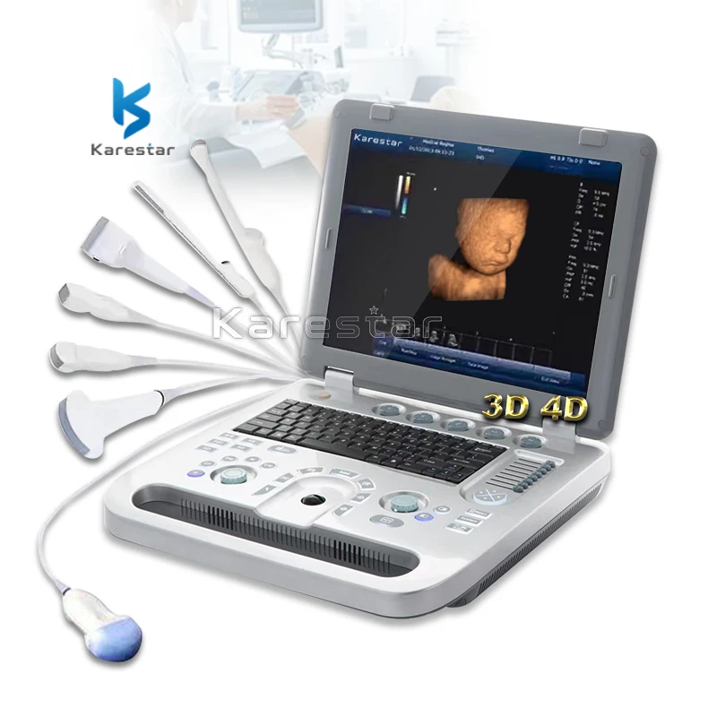 Prodotti Soggetti A Negozionationportable Ultrasound Auto Imt Color Doppler Ultrasound Machine Ecografo Sonoscape
