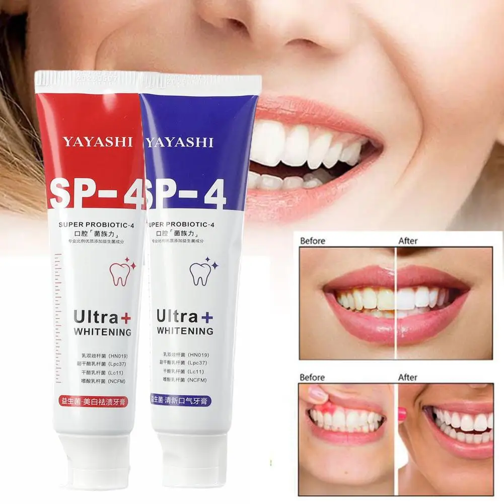 Sdotter Probiotici Sbiancare I Denti Rapidamente Dentifricio Riparazione Cavità Dente Giallo Smacchiatore Prodotti Sbiancanti Per Denti Oral Hygi