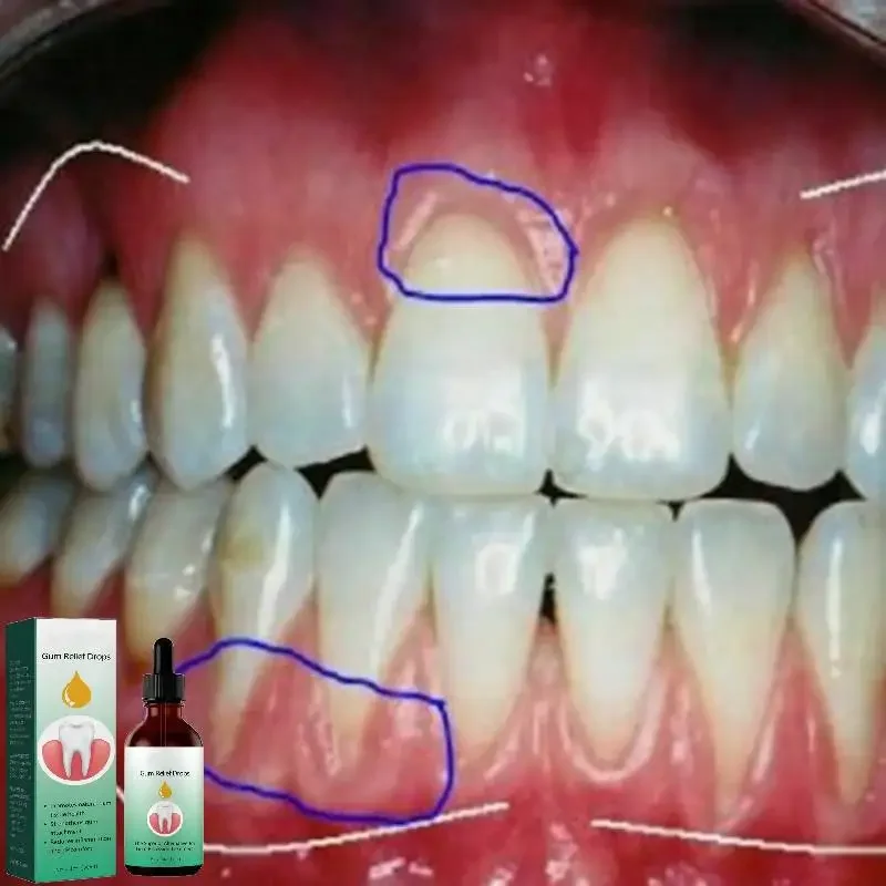 Riparazione Delle Cavità Carie Dentifricio Denti Puliti Prodotti Per La Cura Delle Gengive Naturali Sbiancare Rimuovere Le Macchie Di Placca Gialla Al