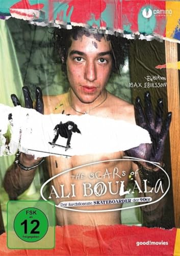 The Scars Of Ali Boulala