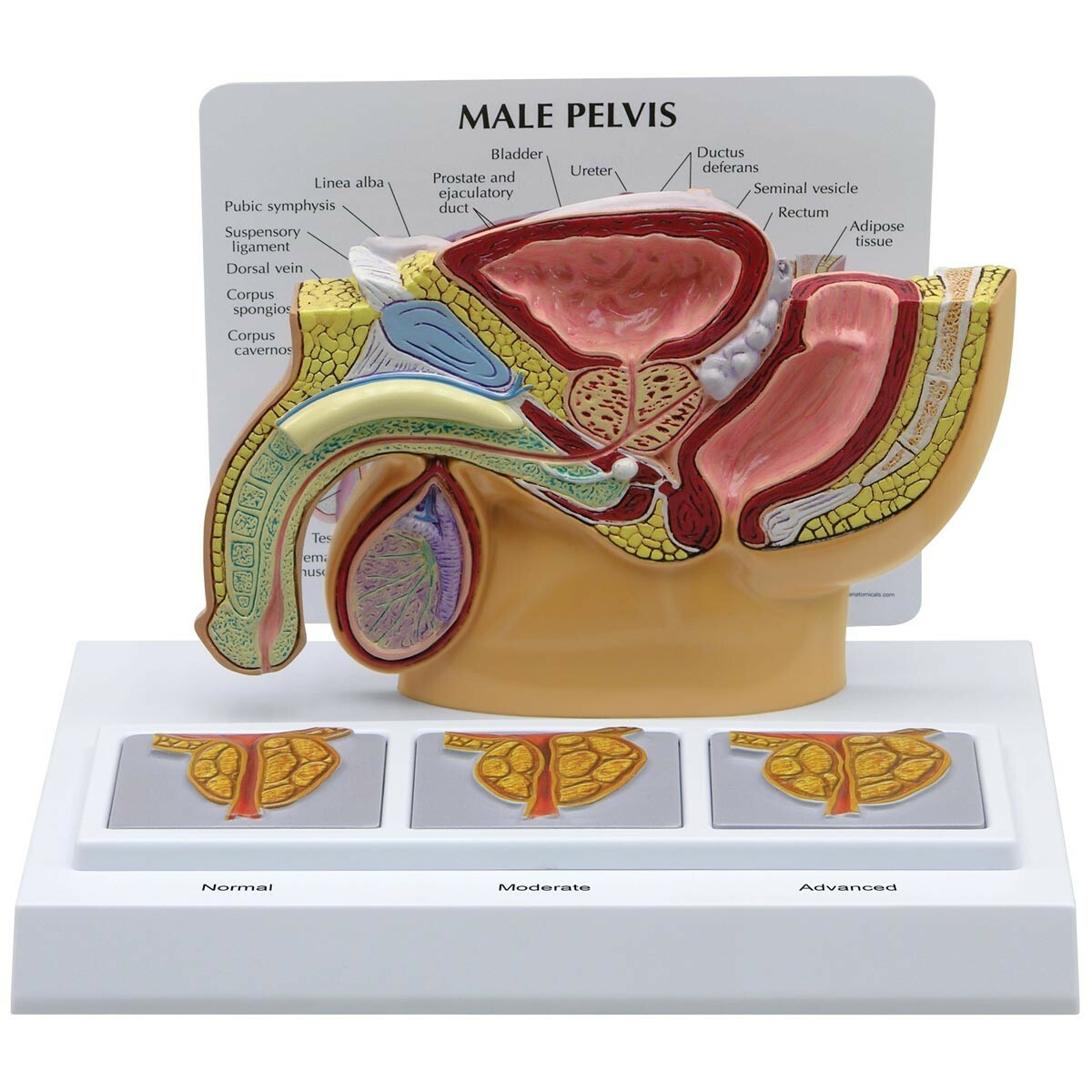 Modello anatomico di Pelvi maschile con prostata 3D in sezione 3B Scientific 101