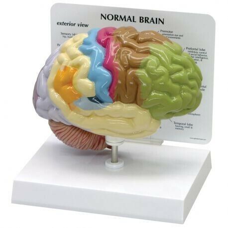 Modello anatomico di mezzo cervello normale 3B Scientific 1019543