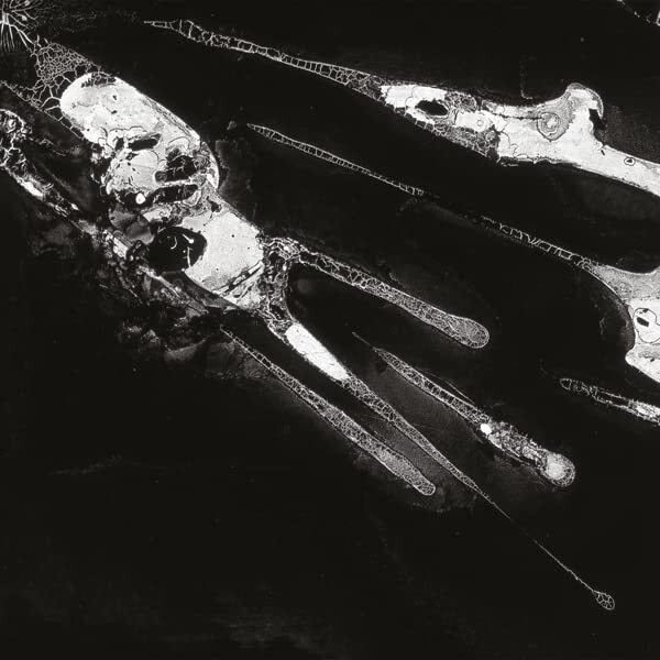 Pschic Health Pschic Health (Vinyl LP)