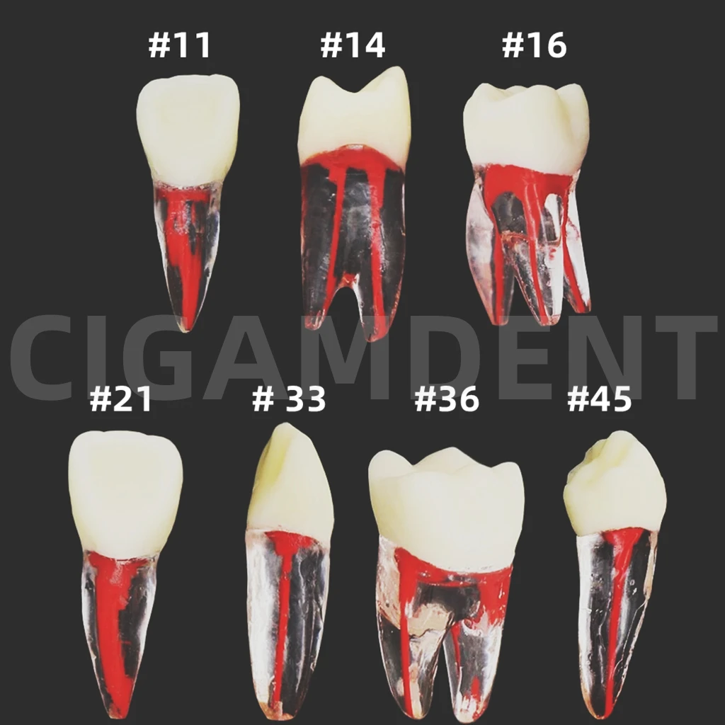 7Pcs Dental Endodontic Root Canal Rct Practice Endo Teeth Tooth Model Pulp Study